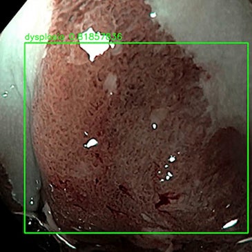 A.I. Enabled Medical Platforms
