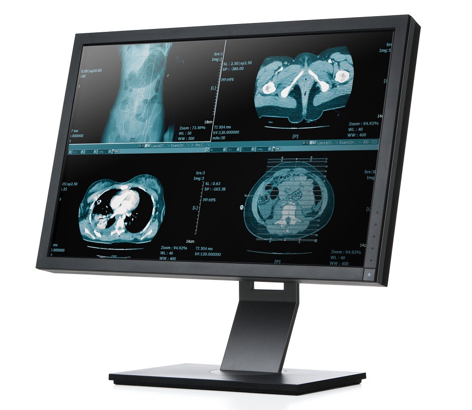 Display Systems Display Systems